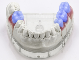 Zahnimplantate, Zahnarztpraxis Ruth Hennes
